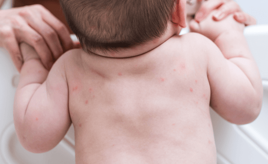 Identify and Eliminate Environmental Irritants