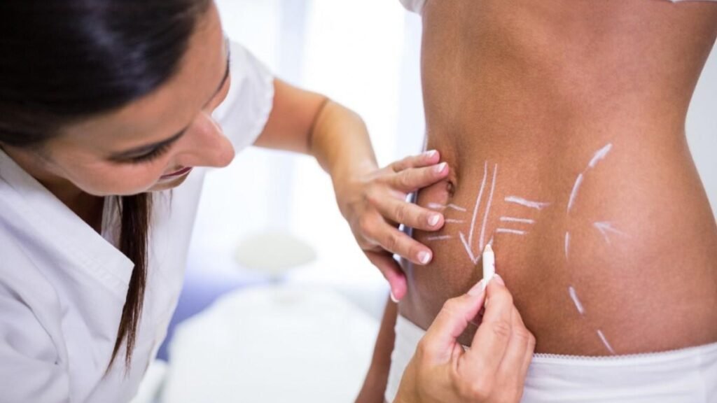 Setting realistic expectations